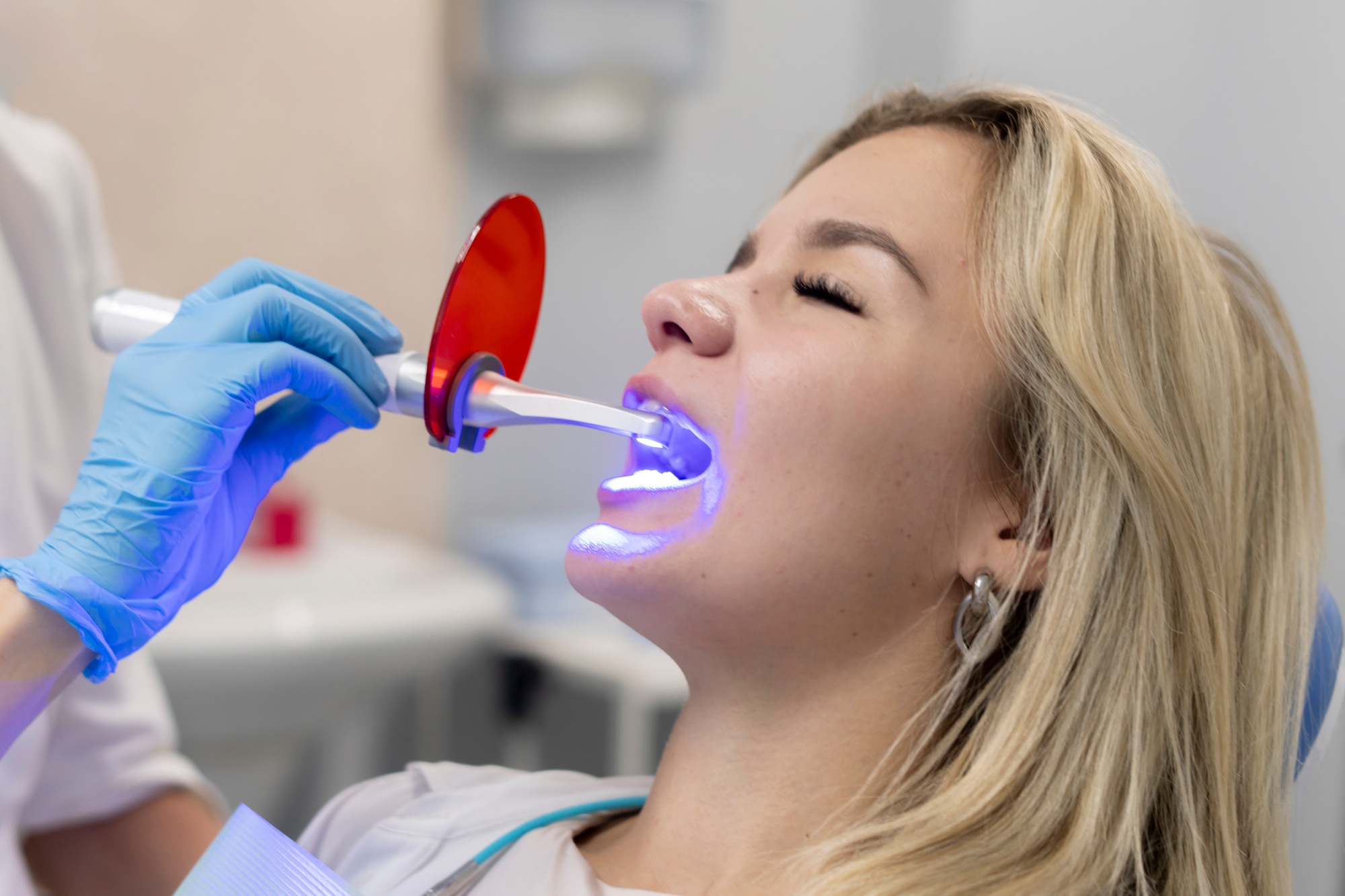 a young girl on a teeth whitening treatment, using ultraviolet lamp for bleaching