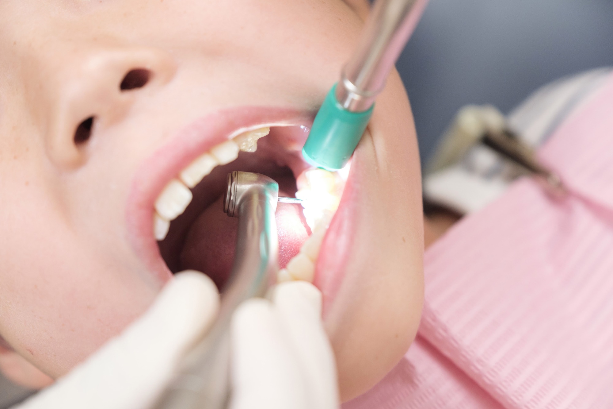Japanese children being treated by a dentist.